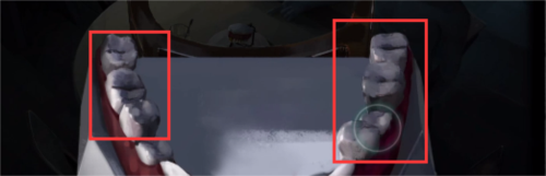 黑暗笔录金牙怎么获得 道具获取攻略